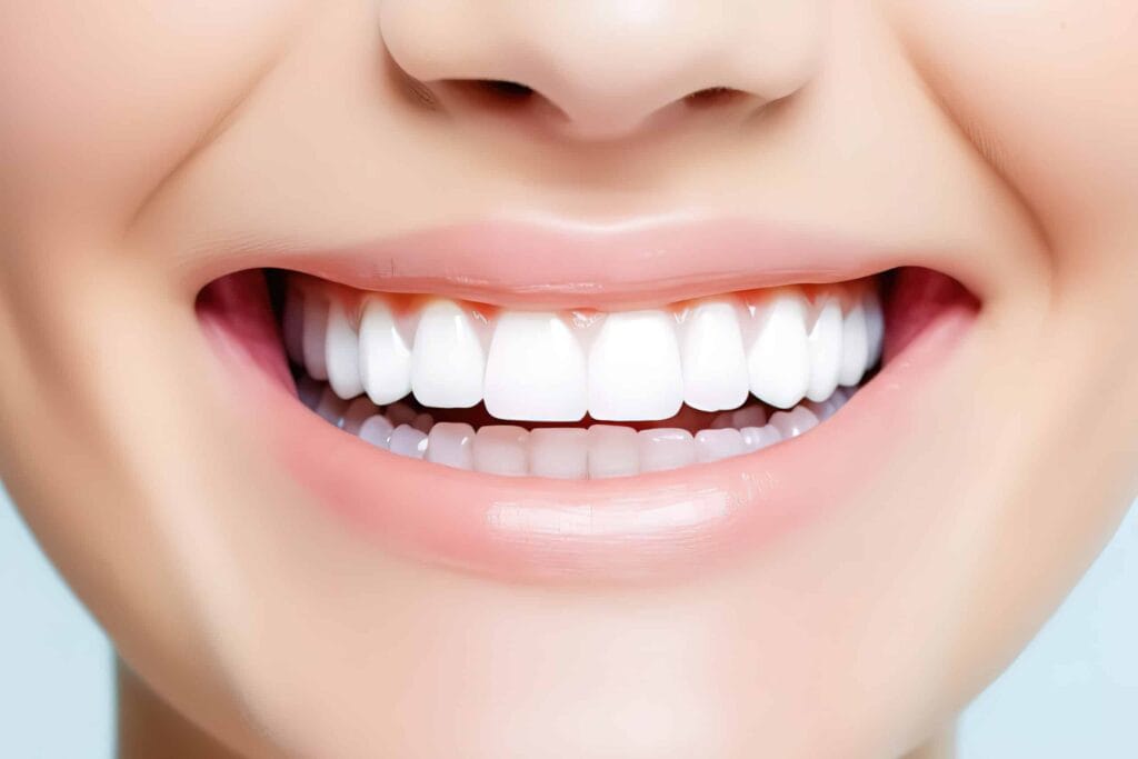 Full Mouth Veneers Cost in the Dominican Republic – What to Expect