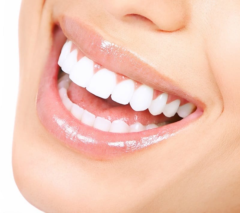 Transform Your Smile with World-Class Veneers in the Dominican Republic